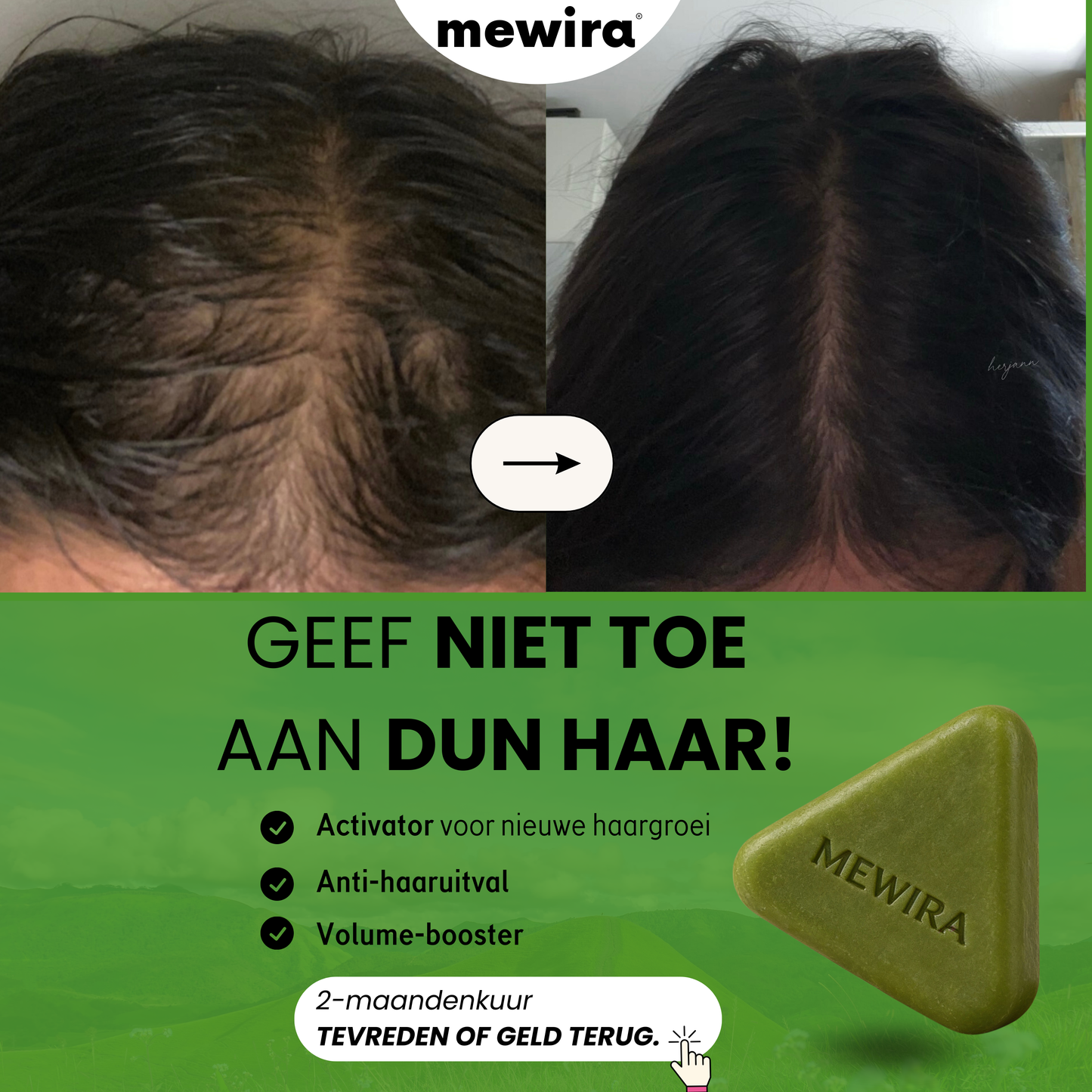 MEWIRA - Koreaanse haargroei-zeep met 12 planten